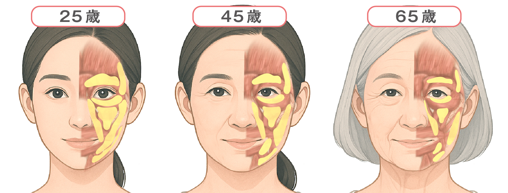 脂肪の減少