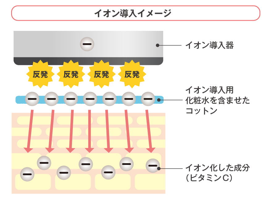 イオン導入の仕組み