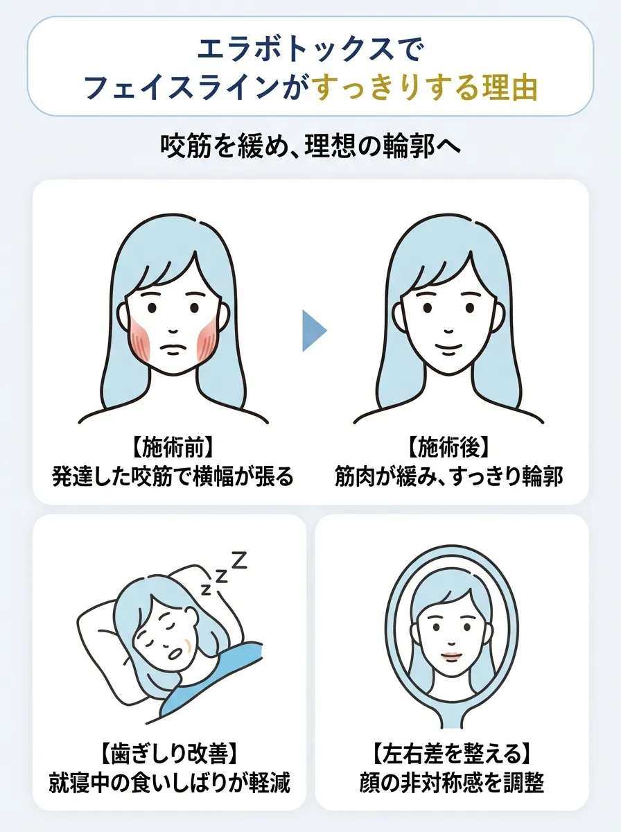 エラボトックスは薬剤の効果でフェイスラインの筋肉を緩めてすっきり見せる施術