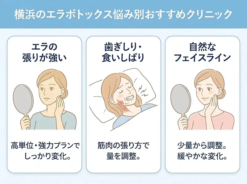 横浜のエラボトックス