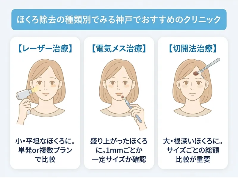 神戸で受けられるほくろ除去の種類