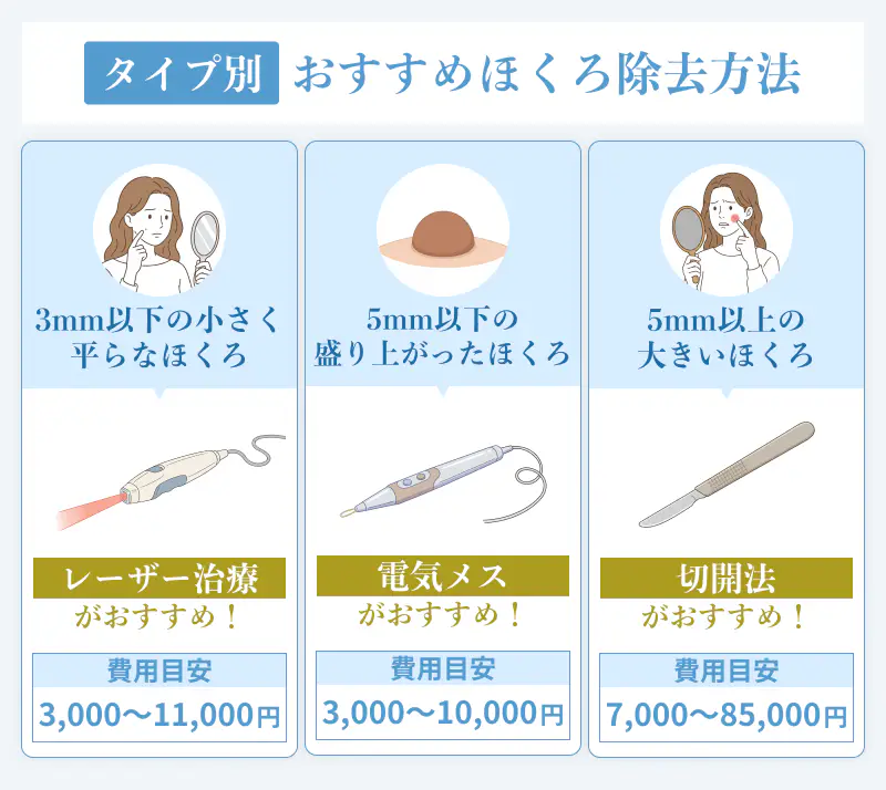 ほくろ除去の施術の違い
