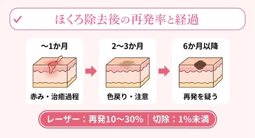 ほくろ除去後の再発率と現れやすい時期
