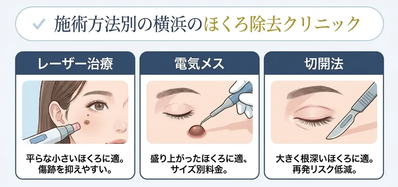 施術方法別で横浜のほくろ除去クリニックを紹介