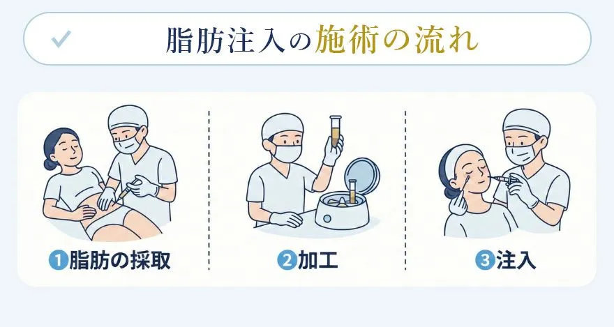 脂肪注入の流れと使われる脂肪の部位