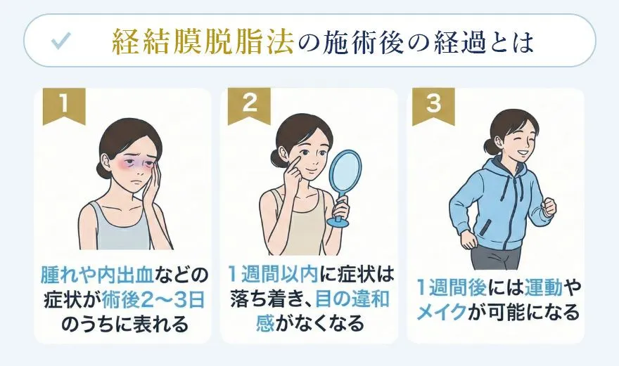 経結膜脱脂法のダウンタイムと回復の過ごし方