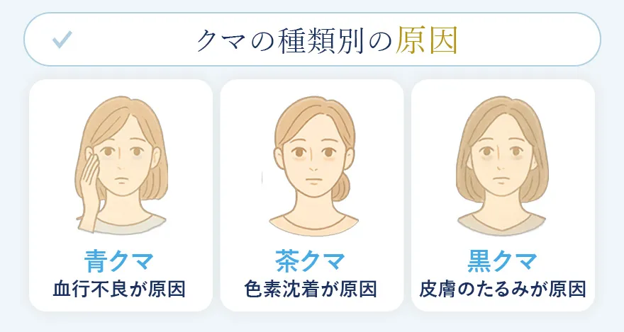 クマができる原因を種類別に解説