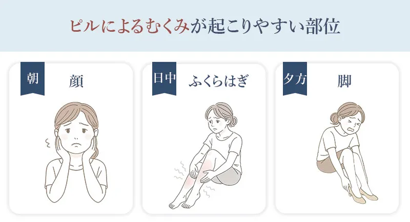 ピルの服用で特にむくみやすい部位