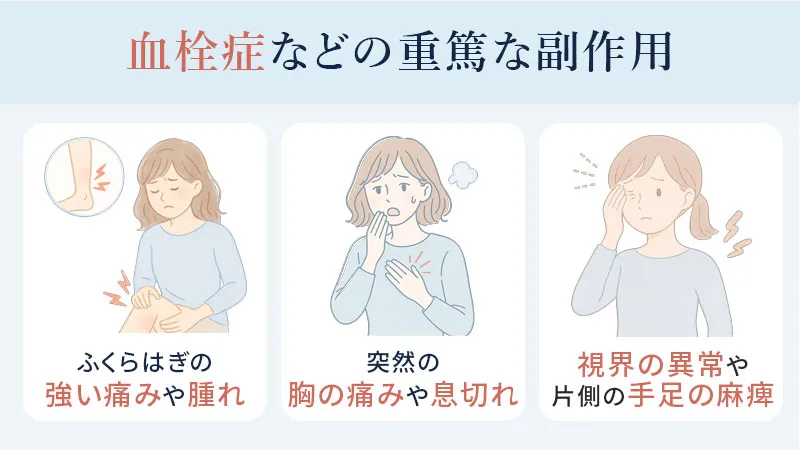 トリキュラーによる血栓症などの重篤な副作用