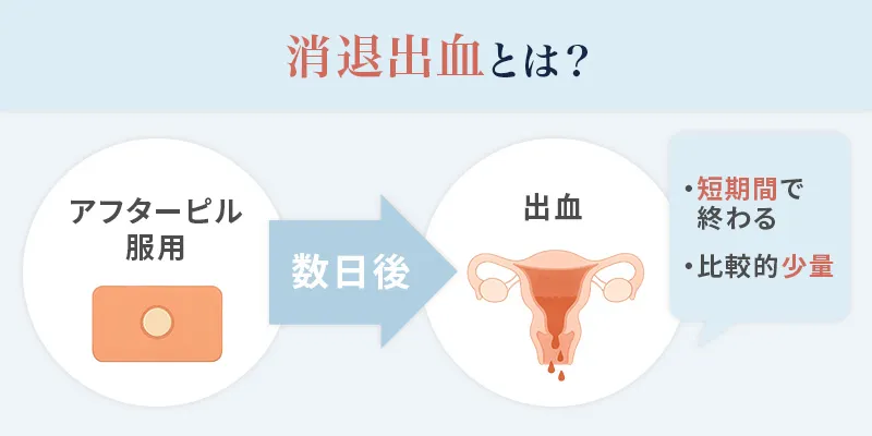 消退出血とはアフターピル服用数日後に起こる出血