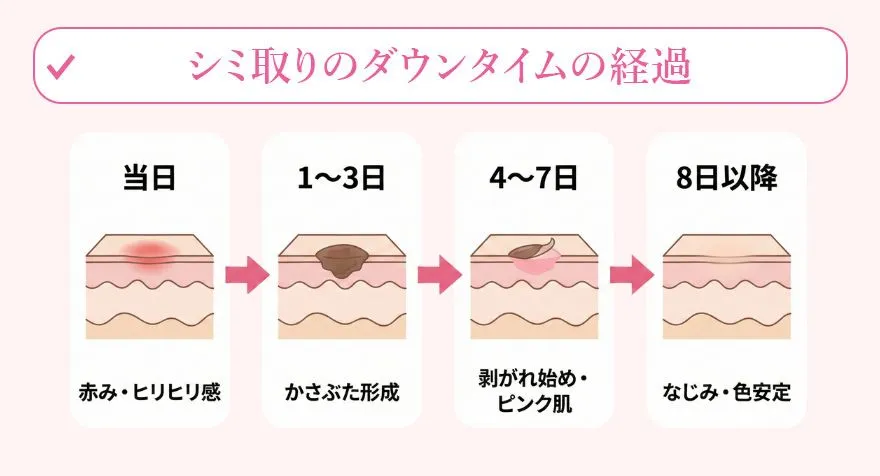 シミ取りのダウンタイムの経過