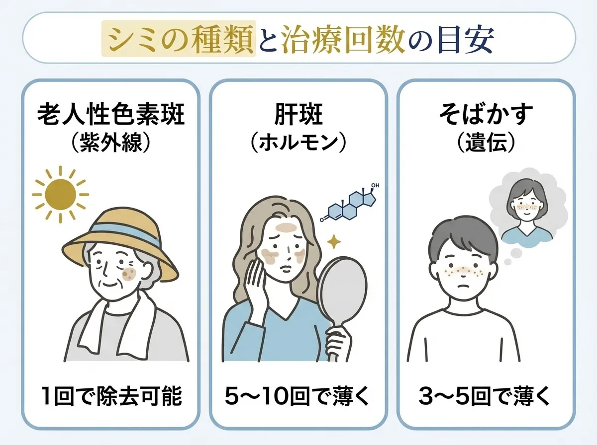 シミの種類ごとの治療回数の目安