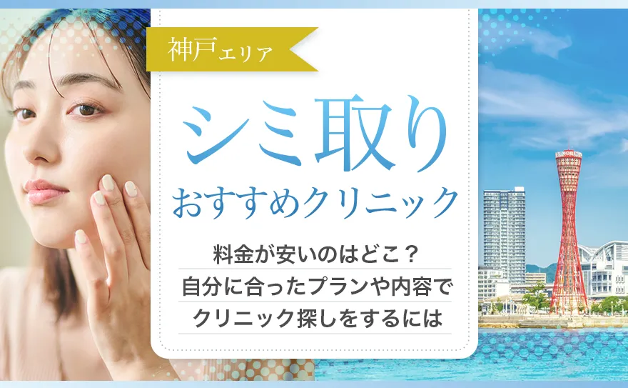 神戸のおすすめシミ取りレーザー