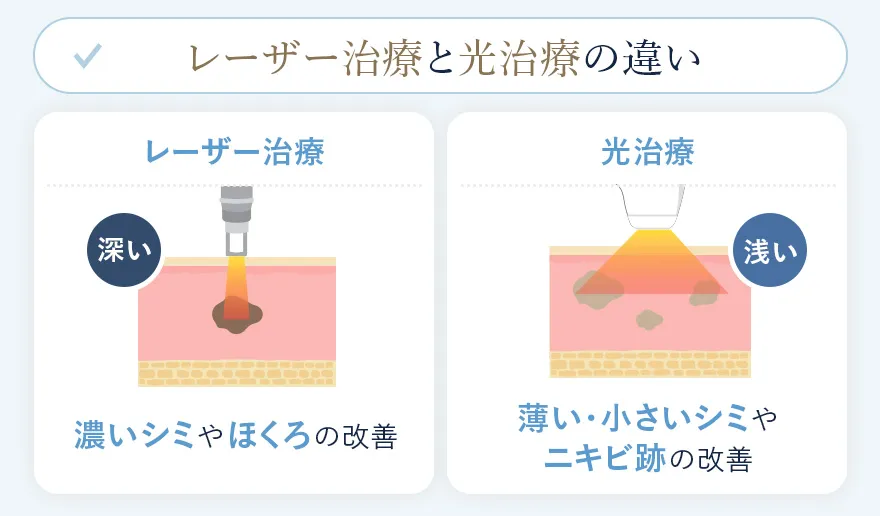 シミ取りレーザーと光治療の違い
