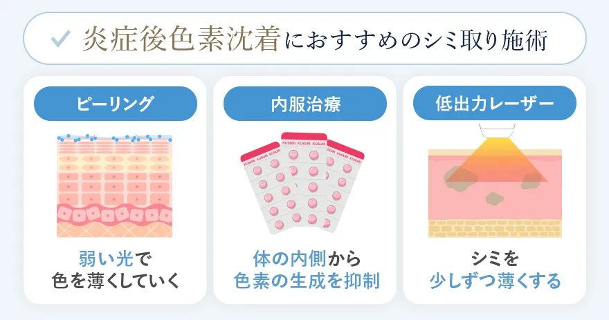 炎症後色素沈着におすすめのシミ取り施術