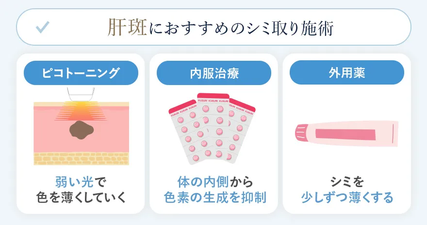 肝斑におすすめのシミ取り施術