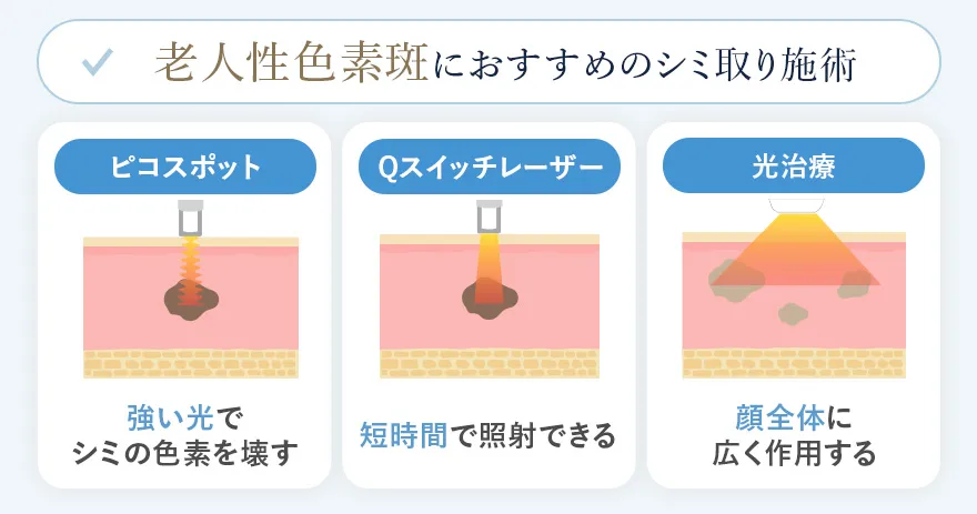 老人性色素班におすすめのシミ取り施術
