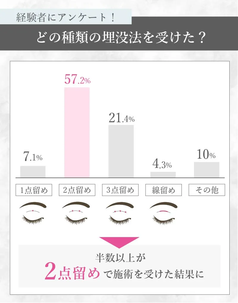 埋没法の種類