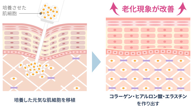 手順はどのようなものですか?
